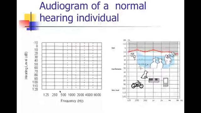 CDIS 4027 Introduction To The Decibel Pt. 2