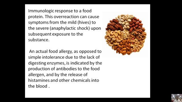 Secondary  Immuno Deficiecncy Dieseas By Prof. Hansa Ram