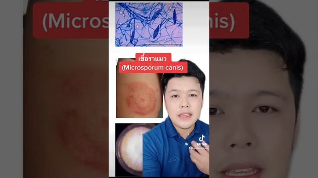 เชื้อราแมว : Microsporum Canis