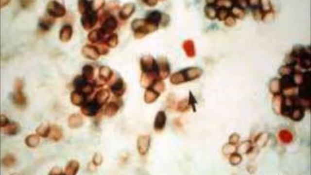 Micología Parasitaria 5. Sistemática: Micosis Oportunistas 2.