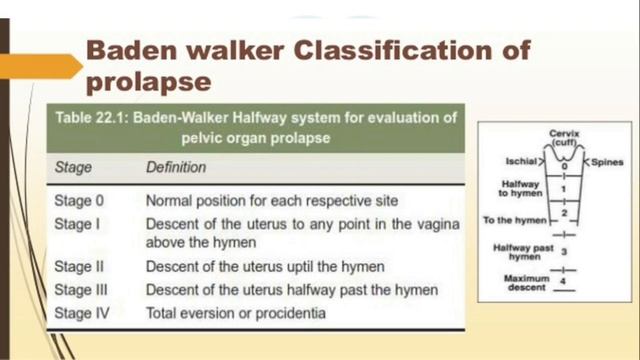NEETPG JANUARY 2019 EXAM | OBG RECALL MCQ | NEET PG 2019 RECALL QUESTIONS | Doctor Capricorn