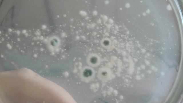 Проверяю био препараты из магазина на наличие заявленных грибов