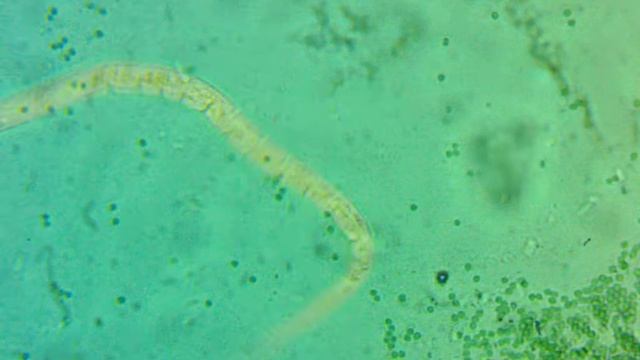 Nemátodo Vs Trichoderma Spp.