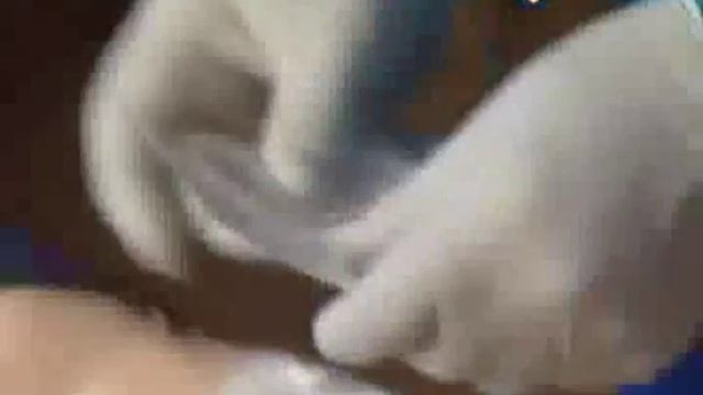 Помощь при кровотечениях 7 мин Avi