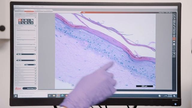 Can We REVERSE Skin Aging? OneSkin, Senescence And The Future Of Skincare.