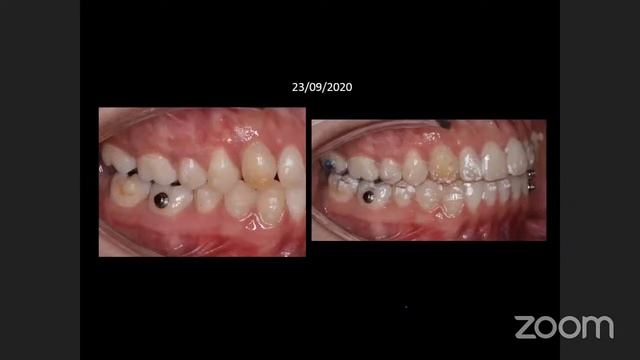 PRESENTACION FINAL DRA. SULLY URIAS