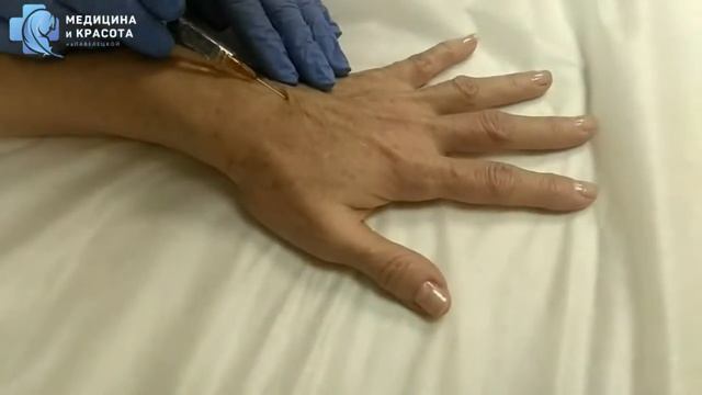 Контурная пластика рук в клинике 
