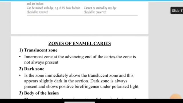 Question Paper Discussion-Conservative Dentistry & Endodontics-Part 1