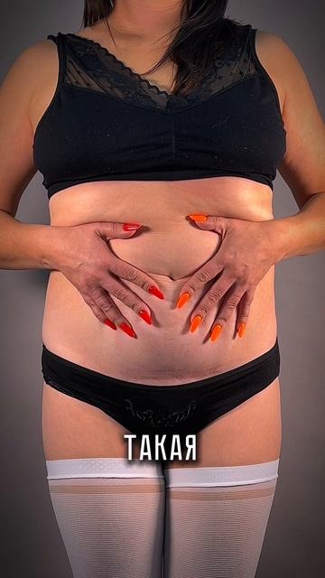 Реалити. Ощущения после абдоминопластики.