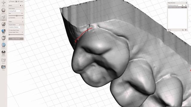 MeshMixer - Closing Distal Diastema