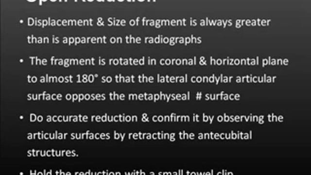 ELBOW: Fixation Of Acute Lateral Condyle Fracture