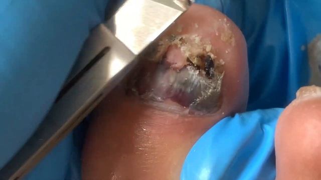 C3511a024a462d4e95e4a1972beda83b