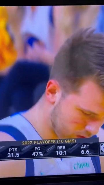Luka Doncic Bleeding #shorts #mavs #lukadoncic #bleeding