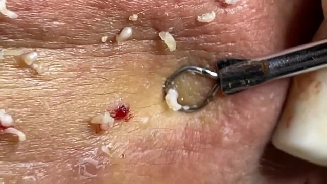 Satisfying Video With Chung Vo Spa | 150