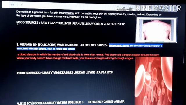 4871d1b921080b71f6b89ef646a54960