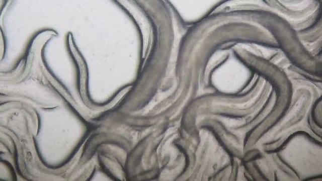 Tuyến Trùng Nematode Trong Cơm Mẻ Dưới Kính Hiển Vi [HD]