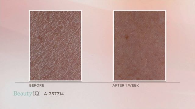 Skinfix Eczema Soothing Wash, 12.5 Oz On QVC