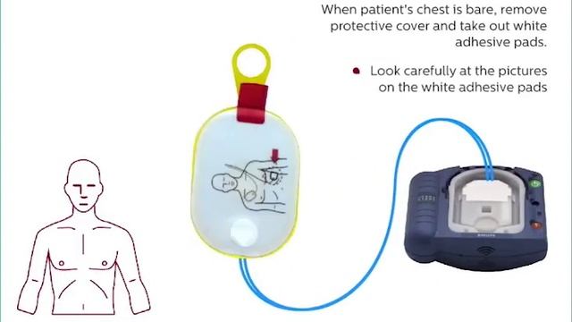 Philips HeartStart Onsite Demo