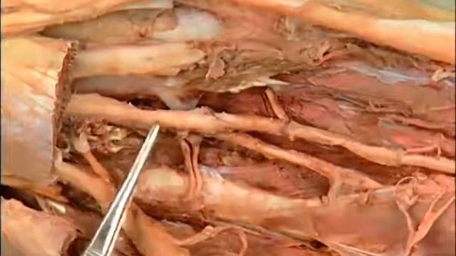 D385b09b651d44b534e96fa5c03fb08a