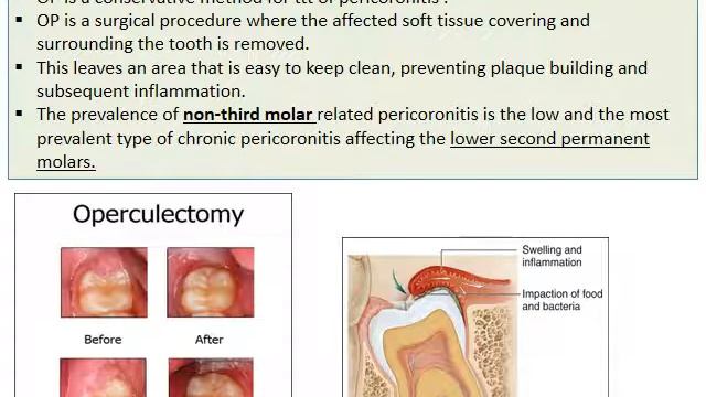 00990968cfaa80520bfe4ac1e84f779e
