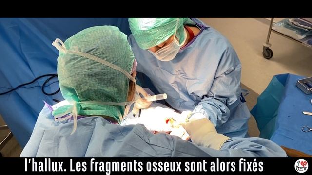 Chirurgie : Qu'est-ce-que L'hallux Valgus ?