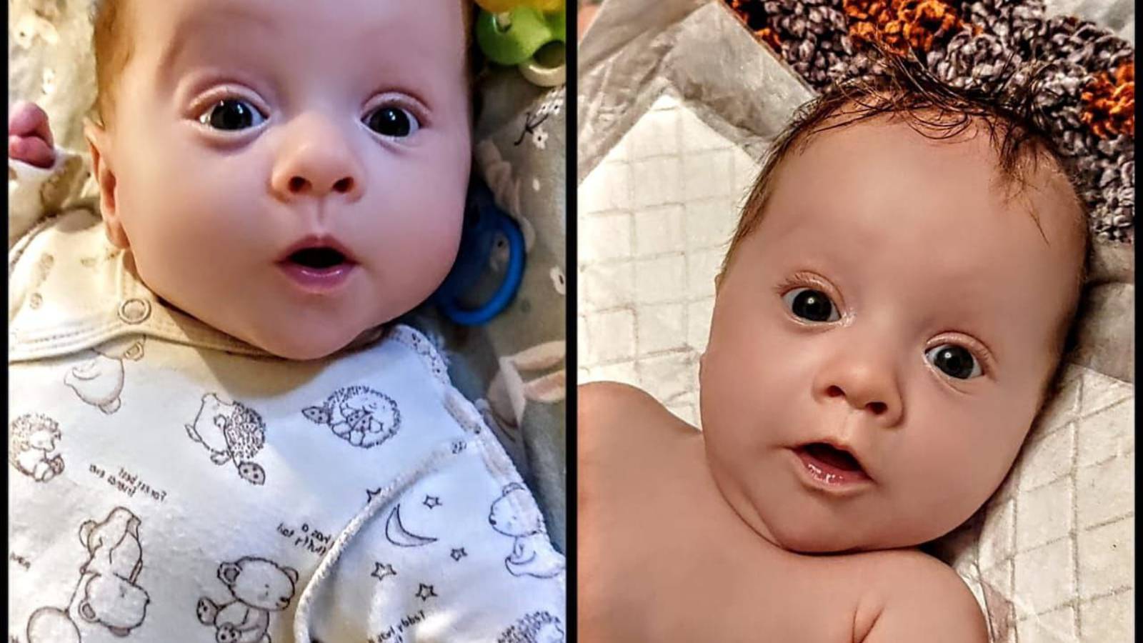 Деформация черепа голова в смятку, как убрать за 30 мин