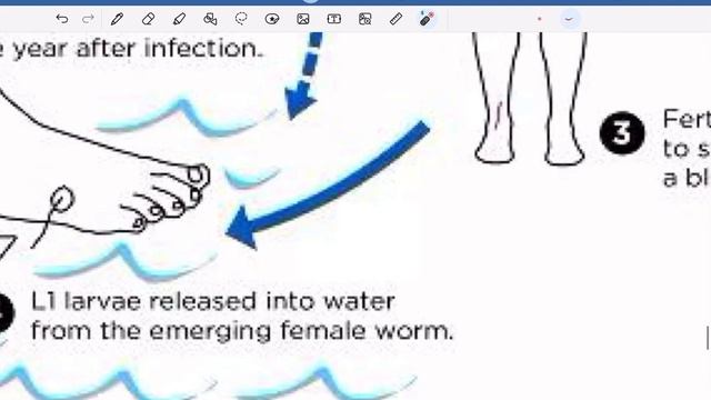 Dracunculus Medinensis & Dirofilaria Immitis