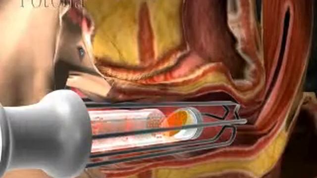 41c7f7a35f23aad7801086fb6035a735