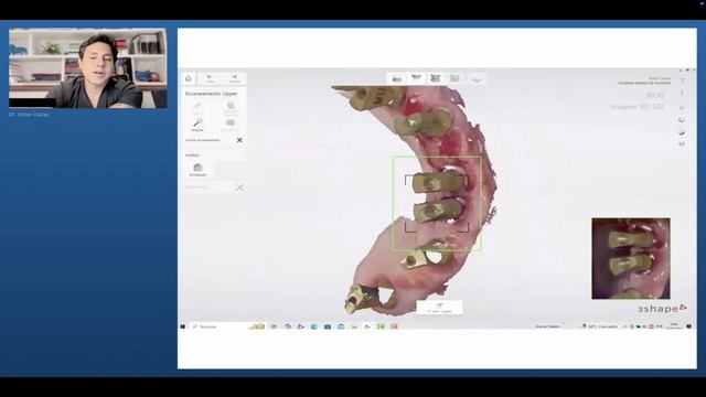 Prof. Victor Clavijo Стратегии для улучшения полных, арочных реставраций, MIS IMPLANTS