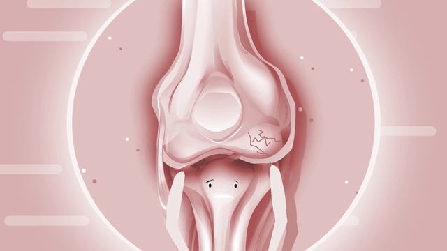 466e8642f5040f244dd57c72a7fbb3f7