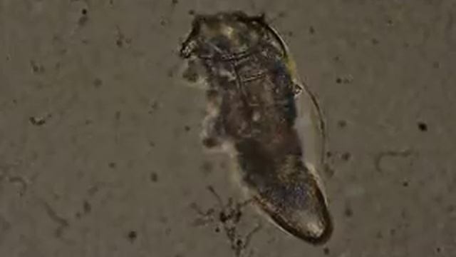 Demodex De Mba5.AVI