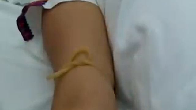 Inyección Intravenosa