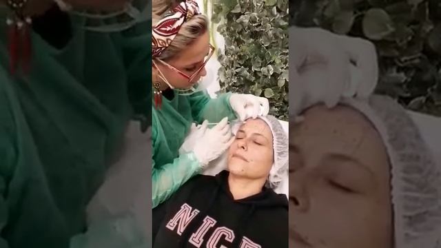 MesoBotox