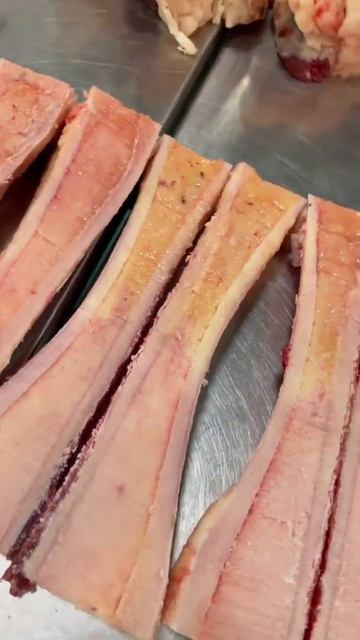 Мозговые кости