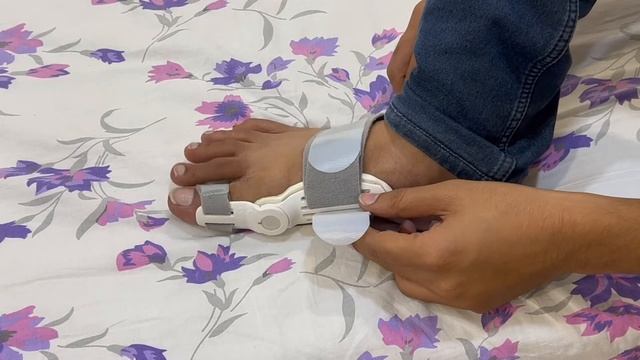 Does Tynor Bunion Splint ACTUALLY Works ? LETS FIND OUT.