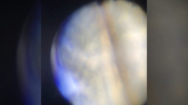 Artemia Salina  X100-x600-x1200