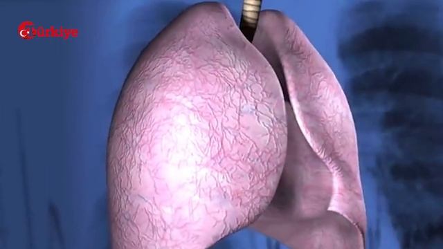 Deprem Bölgesinde Dağ Gibi Yükselen Enkazlarda Asbest Tehlikesi! - Türkiye Gazetesi