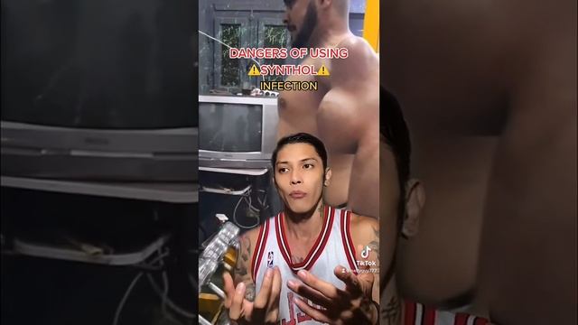 Newest Synthol Beast From The Middle East! | Plus Synthol Spew On Bodybuilding Stage!