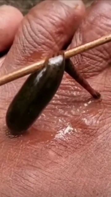 Leech🤢🤮🤮🤮😰#shorts #subscribe #youtubeshorts