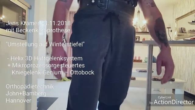 Helix 3D Hüftgelenksystem | Ottobock DE