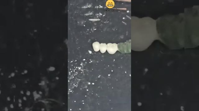 Metallokeramika+ Selnilitoy 😉