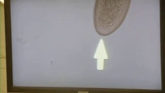 Parasitology 010.AVI
