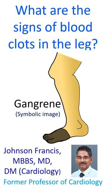 What are the signs of blood clots in the leg?