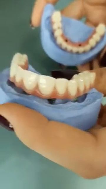 All On 4 / All On Four - все зубы на 4 имплантах за 1 день. Неватекс отзывы