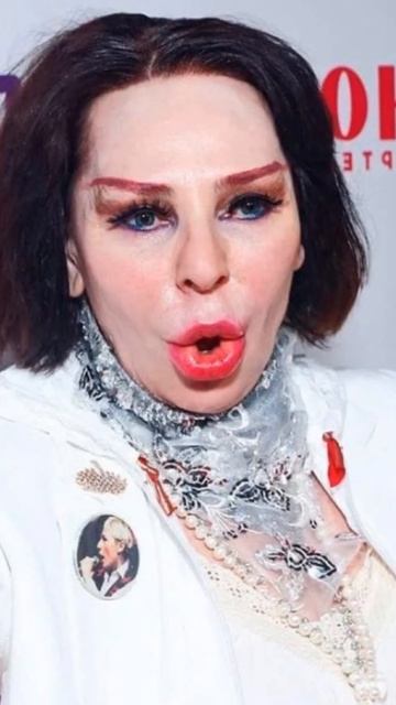 Жанна Агузарова подсела на уколы