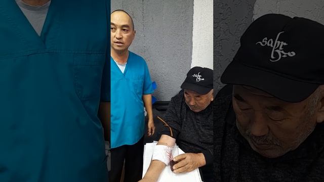 Хиджама пиявки Бишк