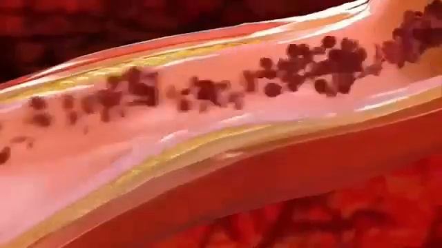 Коректор постави 2