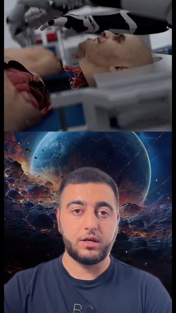 Пересадка головы🤯