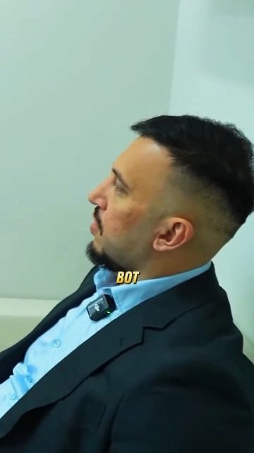 ПЕРЕСАДКА ВОЛОС МЕНЯЕТ ЖИЗНЬ, АМИРАН ДНЕВНИК ХАЧА