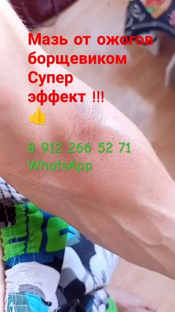 #борщевик #ожоги #целебная #мазь #заживляющая_мазь